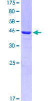 12.5% SDS-PAGE Stained with Coomassie Blue